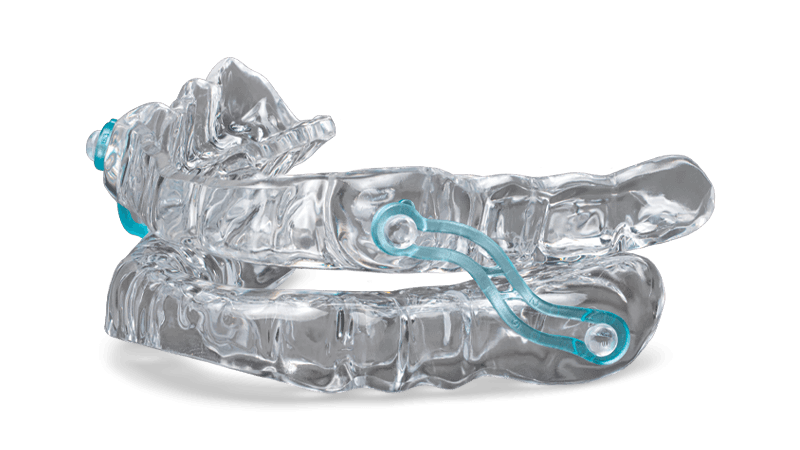 Mandibular advancement device for sleep apnea